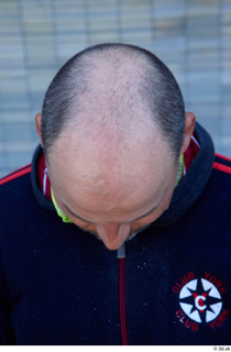 Street  767 bald hair head 0001.jpg